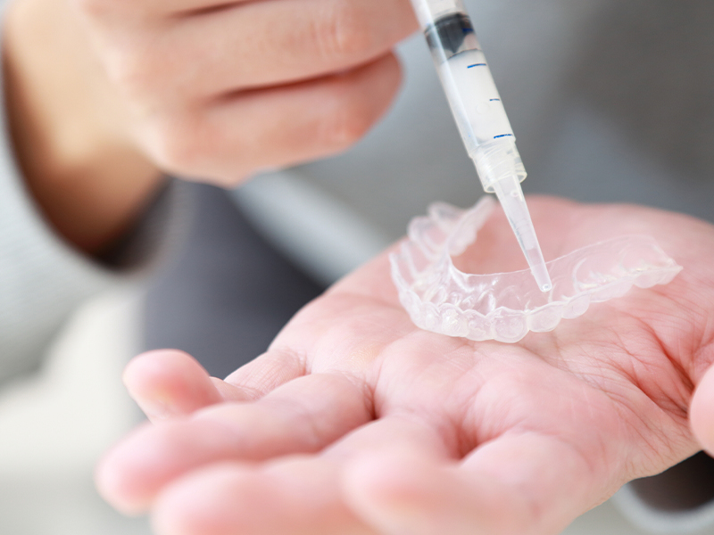 ホームホワイトニング